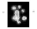Fig. 01 - Methods and apparatus for image analysis using threshold compactness features