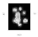 Fig. 06 - Methods and apparatus for image analysis using threshold compactness features