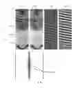 Fig. 04 - Cyclic noise removal in borehole imaging