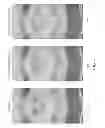 Fig. 06 - Cyclic noise removal in borehole imaging