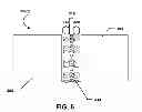 Fig. 07 - Torque Limiting Tolerance Ring