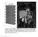 Fig. 02 - Method for Detection of Characteristics of Organ Fibrosis
