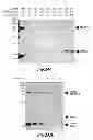 Fig. 35 - Methods for Treating Disseminated Intravascular Coagulation by Inhibiting MASP-2 Dependent Complement Activation