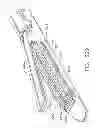Fig. 197 - Tissue thickness compensator configured to redistribute compressive forces