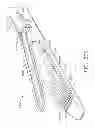Fig. 216 - Tissue thickness compensator configured to redistribute compressive forces