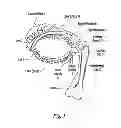Fig. 02 - Method for preventing nasolacrimal duct obstruction