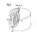 Fig. 06 - Fuel cell and a method of manufacturing a fuel cell
