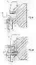Fig. 04 - Aesthetic self-ligating orthodontic bracket