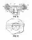 Fig. 06 - Aesthetic self-ligating orthodontic bracket