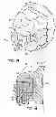 Fig. 08 - Aesthetic self-ligating orthodontic bracket