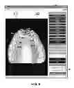 Fig. 07 - Dental occlusion analysis tool