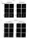 Fig. 09 - Methods of Diagnosing Breast Cancer