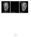 Fig. 22 - Rationale, methods, and assays for identifying human and non-human primate taste specific genes and use thereof in taste modulator and therapeutic screening assays