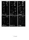 Fig. 44 - Rationale, methods, and assays for identifying human and non-human primate taste specific genes and use thereof in taste modulator and therapeutic screening assays