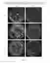 Fig. 03 - strains and method of using strains