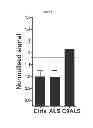 Fig. 07 - Methods and materials for detecting C9ORF72 hexanucleotide repeat expansion positive frontotemporal lobar degeneration or C9ORF72 hexanucleotide repeat expansion positive amyotrophic lateral sclerosis