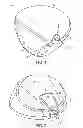 Fig. 02 - Golf club having removable weight