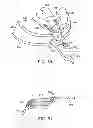 Fig. 22 - Golf club having removable weight