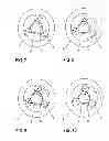 Fig. 04 - MECHANICAL ENERGY STORAGE SYSTEM