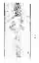 Fig. 09 - METHODS FOR PREIMPLANTATION GENETIC DIAGNOSIS BY SEQUENCING