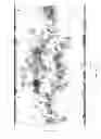 Fig. 12 - METHODS FOR PREIMPLANTATION GENETIC DIAGNOSIS BY SEQUENCING