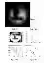 Fig. 07 - Encoding of microcarriers