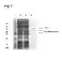 Fig. 02 - Molecule for treating an inflammatory disorder