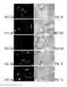 Fig. 04 - Methods for producing interfering RNA molecules in mammalian cells and therapeutic uses for such molecules