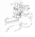 Fig. 01 - Side looking minimally invasive surgery instrument assembly