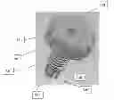 Fig. 01 - Systems and Methods for Surgical Access to Delicate Tissues