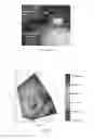 Fig. 21 - System and method for detecting tissue surface properties