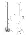 Fig. 02 - METHOD AND APPARATUS FOR IN VIVO COLLECTION OF CIRCULATING BIOLOGICAL COMPONENTS