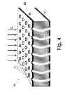 Fig. 05 - PET/MR scanners for simultaneous PET and MR imaging
