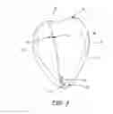 Fig. 04 - Pericardial space imaging for cardiac support device implantation