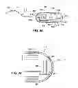 Fig. 04 - Optical capsule and spectroscopic method for treating and diagnosing the intestinal tract