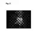 Fig. 03 - Method for diagnosing cancer
