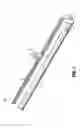 Fig. 02 - Ring laser for use with imaging probe as a safe margin indicator