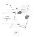Fig. 02 - SYSTEMS AND METHODS FOR ANALYZING ELECTROCARDIOGRAMS TO DETECT VENTRICULAR FIBRILLATION