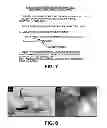 Fig. 06 - Method and device for statistical tissue sampling using microdevices