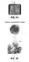 Fig. 08 - Method and device for statistical tissue sampling using microdevices