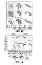 Fig. 09 - Method and device for statistical tissue sampling using microdevices