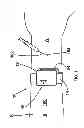 Fig. 02 - Device and method for the reduction of pain associated with needle sticks