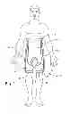 Fig. 02 - Adjustable orthostatic intolerance system and garment