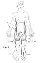 Fig. 09 - Adjustable orthostatic intolerance system and garment
