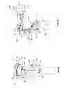 Fig. 07 - Orthopedic device for treating complications of the hip