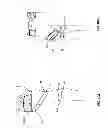 Fig. 08 - Orthopedic device for treating complications of the hip