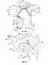Fig. 09 - Orthopedic device for treating complications of the hip