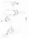 Fig. 15 - Orthopedic device for treating complications of the hip