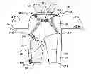 Fig. 01 - Orthopedic device for treating complications of the hip