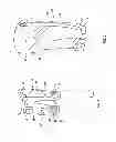 Fig. 02 - Orthopedic device for treating complications of the hip